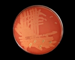 Streptococcus agalactiae, group B